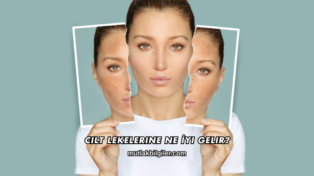 Cilt Lekelerine Ne İyi Gelir?