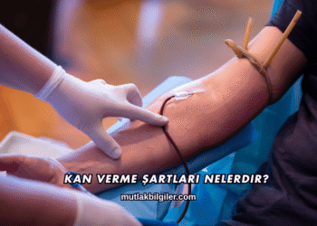Kan Verme Şartları Nelerdir?
