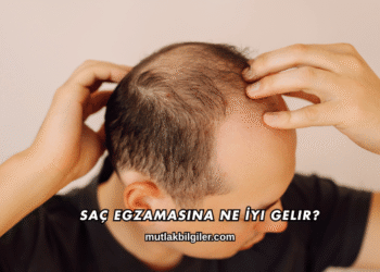 Saç Egzamasına Ne İyi Gelir?