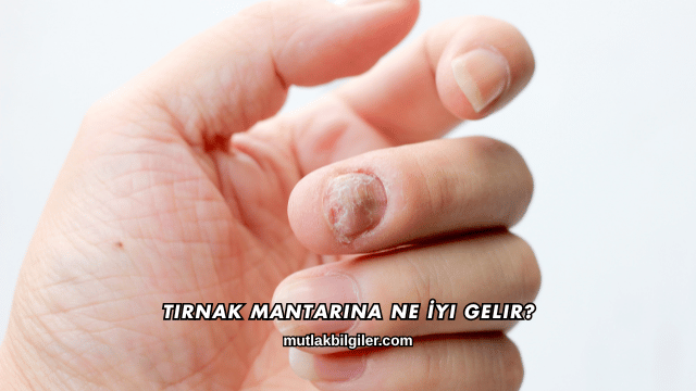 Tırnak Mantarına Ne İyi Gelir?